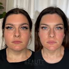 Some new and old lip favorites 💫 By @beautybytaline . #phillybeauty  #phillylipfiller #lipfiller #lipfillerbeforeandafter #phillymedspa