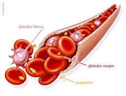Il y a 2 heures|51 vues. Leucemie Lymphoide Age Et Traitements Leucemie Lymphoide Chronique Medipedia