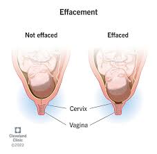 Image result for cervix position