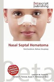 Nasal Septal Hematoma book by Lambert M. Surhone, Mariam T. Tennoe, Susan  F. Henssonow: 9786135058116