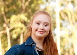 Madeline Stuart : Le top trisomique qui casse les codes de la mode