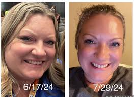 What have your results been like with Kidney Restore?