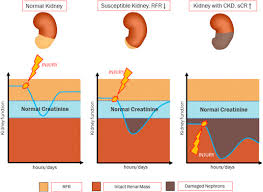Image result for Renal Function