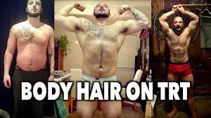 Trt before and after pics. My Body Hair On Trt Before After Testosterone Replacement Therapy Youtube
