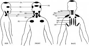 Riew breaks down the causes and symptoms of. Tenderness Was Assessed By Palpation Of 18 Neck Shoulder Muscles 15 Download Scientific Diagram