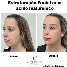 Dra. Fernanda Bianco (@drafernandabianco) • Instagram photos and videos