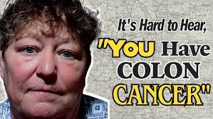 Mercy Surgery Center Leader Dawn Simonsen's Colon Cancer Journey