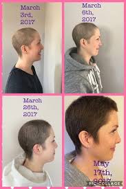 Post Chemotherapy And Radiation Results Of Growth Using Monat Hair Growth After Chemo Monat Hair Hair Regrowth