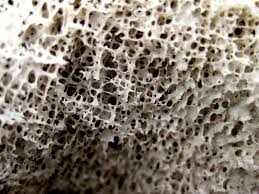 A cross section of a compact bone shows concentric circles called lamellae. Bone Cross Section Scope