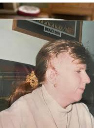 In May, 2019, I had a ruptured brain aneurysm. I was 49 years old. Doctors  told my son I had a 20% chance of surviving. The aneurysm caused me to have  a