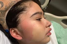 Fundraiser by Ashley Ramirez : Nayelies fight against ALL LEUKEMIA