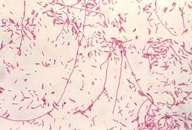 Extrapulmonary legionella causing myocarditis, pericarditis, prosthetic endocarditis, sinusitis, cellulitis, pancreatitis, peritonitis & pyelonephritis have all been described. Details Public Health Image Library Phil