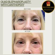 Vu Plastic & Cosmetic Surgery