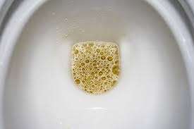 Foamy Urine? 7 Causes You Shouldn't Ignore (Proteinuria Explained)