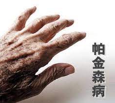 求 泰 剧(玻 璃 面 具). è­¦æƒ• é¢å…·è‡‰ å¸•é‡'æ£®ç—…æ‰¾ä¸Šäº†å¹´è¼•äºº æ¯æ—¥é ­æ¢