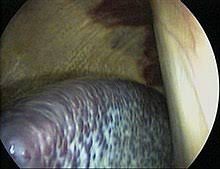 Left hand side of your body, between your stomach and diaphragm. Spleen Wikipedia