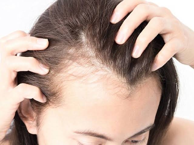 Ngứa da đầu: Nguyên nhân và cách điều trị hiệu quả