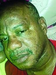 Gregory Pendleton Obituary