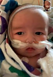 Dr. Aaron performing surgery