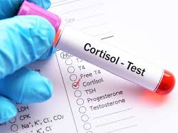 cortisol level test purpose procedure and results