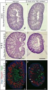 Notch Signaling Regulates Akap12 Expression And Primary Cilia Length During Renal Tubule Morphogenesis Biorxiv