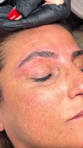 הלחמת גבות באילת: המדריך המלא