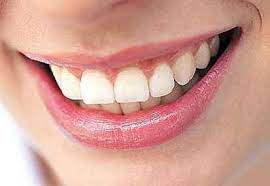 Orang dewasa memiliki 8 gigi geraham kecil, 2 dirahang atas sebelah kanan, 2 di rahang atas sebelah kiri, 2 di rahang bawah sebelah kanan. Berapa Banyak Jumlah Gigi Yang Dibutuhkan