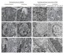 Electron microscopes use a beam of electrons instead of light rays. High Quality Ultrastructural Preservation Using Cryofixation For 3d Electron Microscopy Of Genetically Labeled Tissues Elife