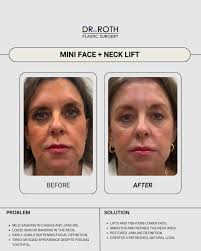 Dr. Roth Plastic Surgery
