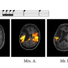 Results Of The Aachener Aphasie Test Aat In Percentile Scores And Download Scientific Diagram