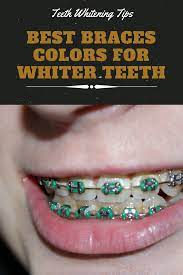 How to whiten teeth fast without baking soda. Pin On General Health Tips