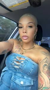 #Fyp Bald Girls Matter