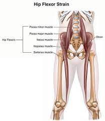 Psoas muscles are deep muscles that connect the spine and legs. Hip Flexor Strain Treatment Doctors Hip Pain Specialists Brooklyn Ny