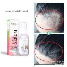 Selama pemakaian rutin dengan hair serum ini, aku merasa rambut ku yang kering jadi. 13 Serum Rambut Yang Bagus Untuk Atasi Rambut Rontok Bercabang Updated 2020 Bukareview