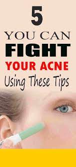 Thanks To Medical Studies And Research We Know Know That Acne Is Not Caused By Pizza Or Chocolate Or The Other Things That Ha Medical Studies Acne Care Acne