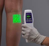 Accuvein AV500 Vein Viewer | Brand New Portable Vein Finder for IV &  Phlebotomy