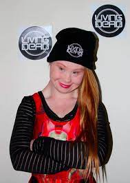 Fans Of Model With Down Syndrome Make Big Request To People Magazine Down Syndrome Living Dead Clothing Madeline Stuart