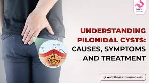 Image result for Pilonidal Cyst