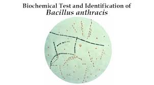 biochemical test and identification of bacillus anthracis