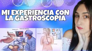 MI EXPERIENCIA CON LA GASTROSCOPIA
