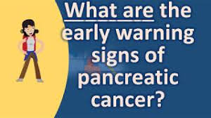 However, watch for these signs: What Are The Early Warning Signs Of Pancreatic Cancer Find Health Questions Youtube