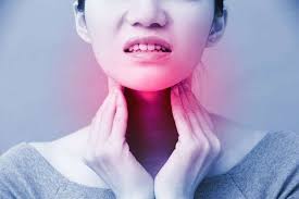 Nhiều triệu chứng liên quan với bệnh ung thư cổ họng cũng giống như dưới đây là một số dấu hiệu ban đầu của ung thư vòm họng bạn cần lưu tâm: Ung ThÆ° Háº¡ Há»ng Nguyen Nhan Triá»‡u Chá»©ng Cháº©n Ä'oan Va Ä'iá»u Trá»‹
