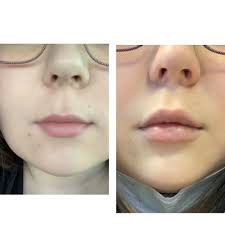 TOP 10 BEST Laser Skin Care in Bozeman, MT