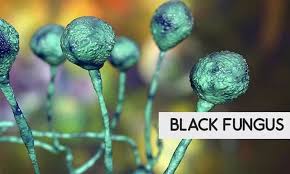 People think black fungus is contagious and can pass through contact or oxygenation or by use of humidifier. Rise Of Black Fungus Cause For Concern