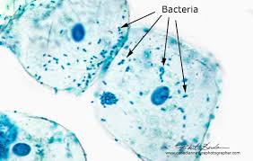 Check spelling or type a new query. Tips For Buying A Light Microscope Compound Inverted And Stereoscope The Canadian Nature Photographer