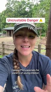 Uncrustable Danger: Be Aware of Hot Food Risks