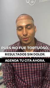 John Bolaños quedó feliz con su trasplante capilar., No sintió dolor  durante el procedimiento y el resultado superó sus expectativas: todas las  zonas quedaron totalmente repobladas., 📅 Agenda hoy tu ...