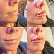 Breana May, FNP-C (@bre_740aesthetics) · Instagram photos and videos