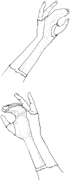 We did not find results for: Basic Principles Of Splinting In The Emergency Department Chapter 14 Sports Medicine For The Emergency Physician