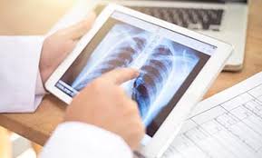 We did not find results for: Pulmonary And Thoracic Surgery Northwestern Medicine